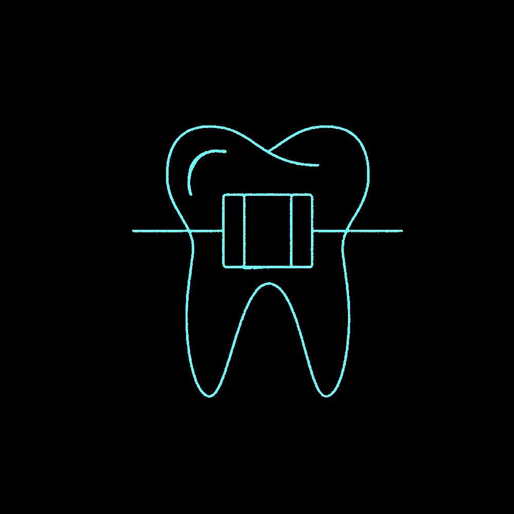 Neon Sign Dental Braces Icon In Line Style Orthodontics Equipment Teeth Alignment Symbol Custom Handmade Real Glass Tube14"X14"